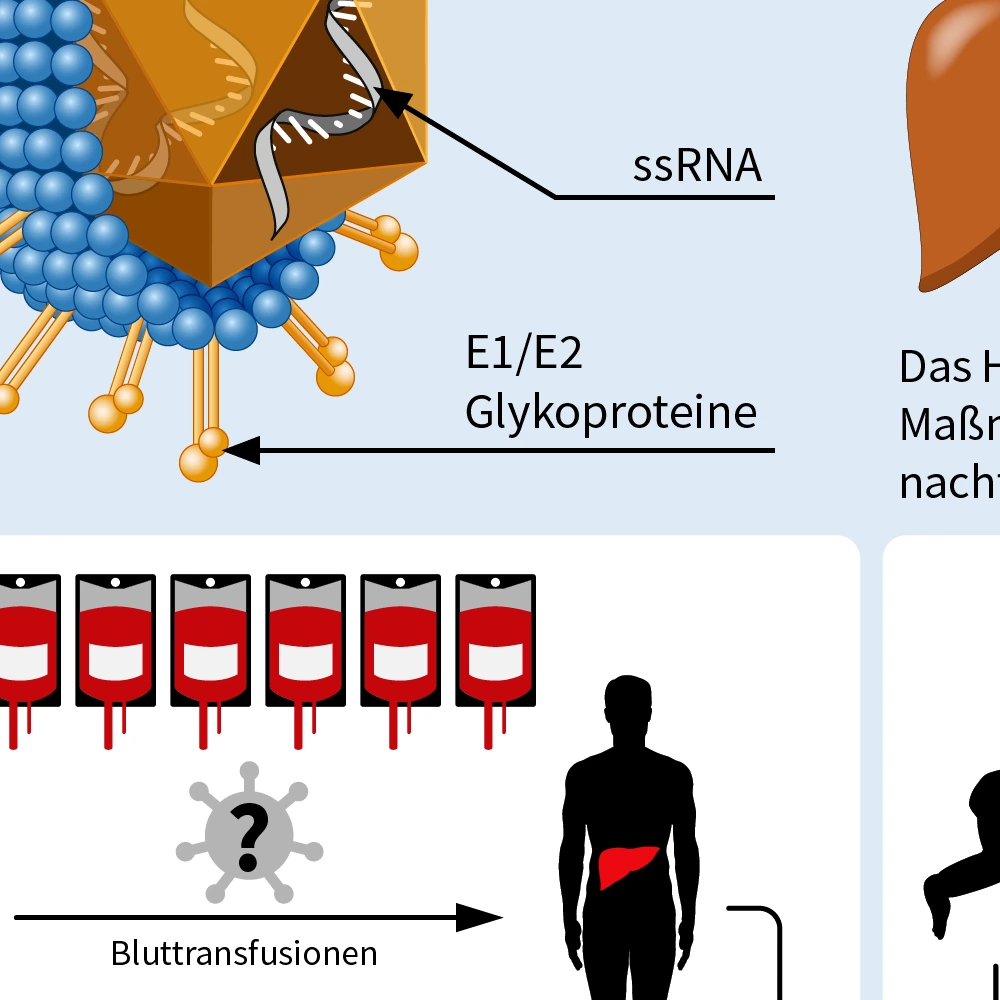 Infografik zum Nobelpreis 2020, Entdeckung von Hepatitis C.
