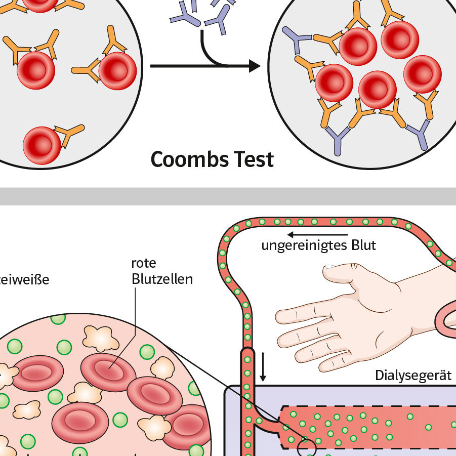 Illustrationen für Schulbuch Biologie zur Immunologie